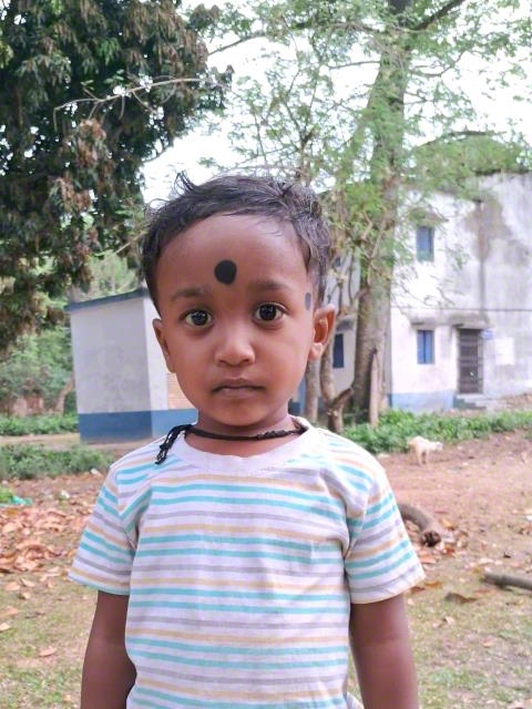 World Vision India